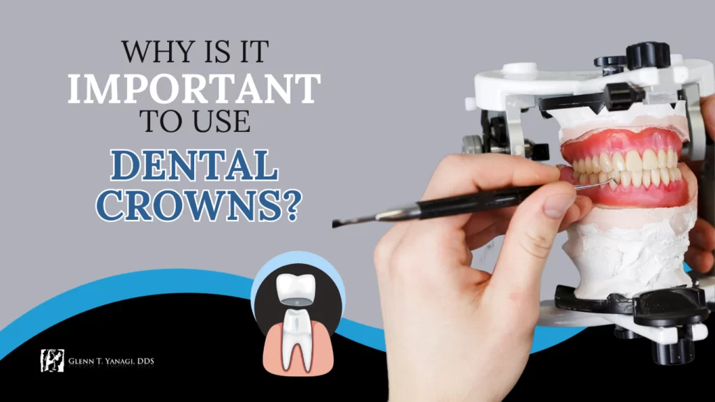 Why is it important to use dental crowns? in Irvine, CA