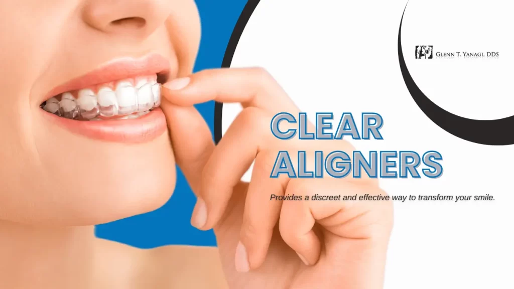 Clear Aligners in Irvine, CA