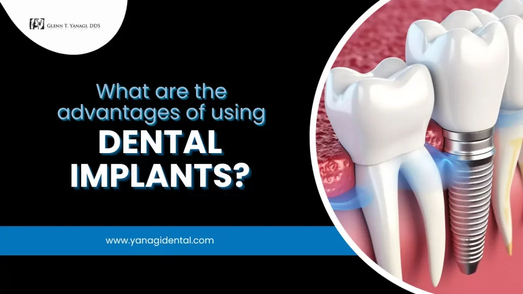 What are the advantage of using Dental Implant? in Irvine, CA